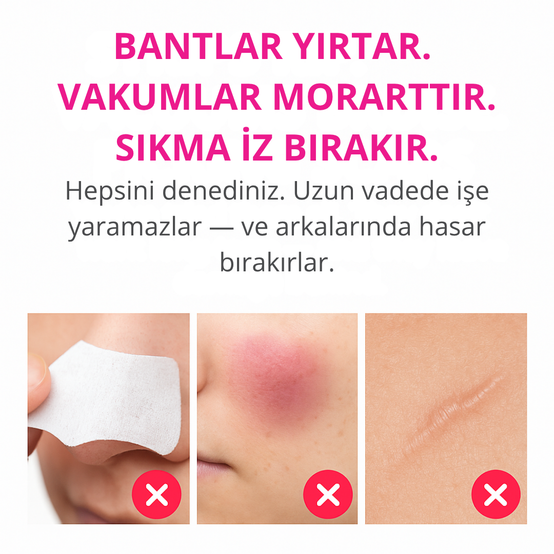 Portem PoreLift™ – Mikro Darbeli Gözenek Temizleme Cihazı