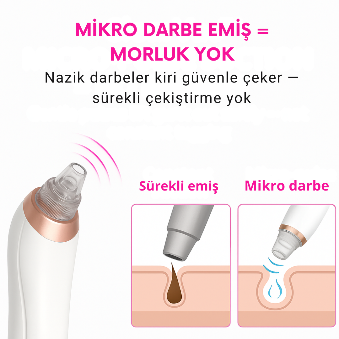 Portem PoreLift™ – Mikro Darbeli Gözenek Temizleme Cihazı