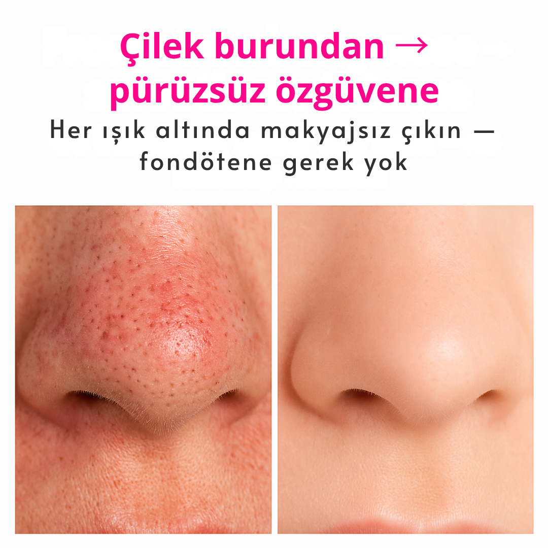 Portem PoreLift™ – Mikro Darbeli Gözenek Temizleme Cihazı