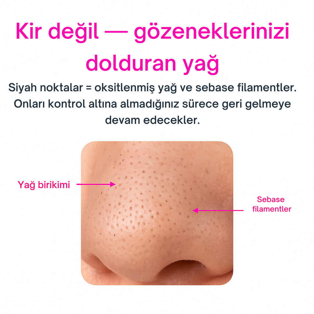 Portem PoreLift™ – Mikro Darbeli Gözenek Temizleme Cihazı